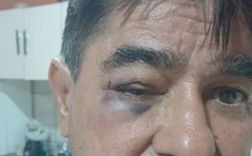 Ex-prefeito de Olivença é agredido em confusão no Centro da cidade