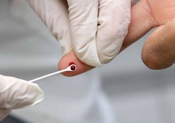 Secretaria leva mutirão de testagem rápida para Aids/HIV à Vila dos Pescadores