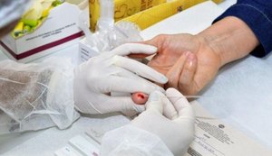 Em 32 anos, Estado de Alagoas registra mais de 6.800 casos diagnosticados de Aids