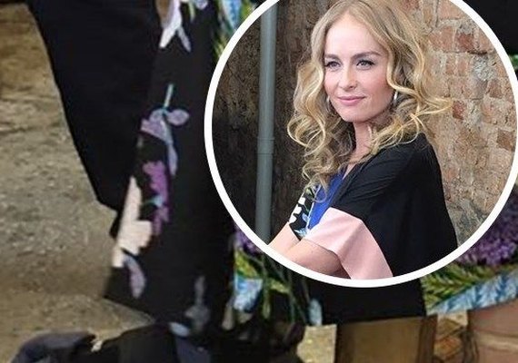Angélica cai de escada e machuca o pé: 'Não sei nem andar de muleta'