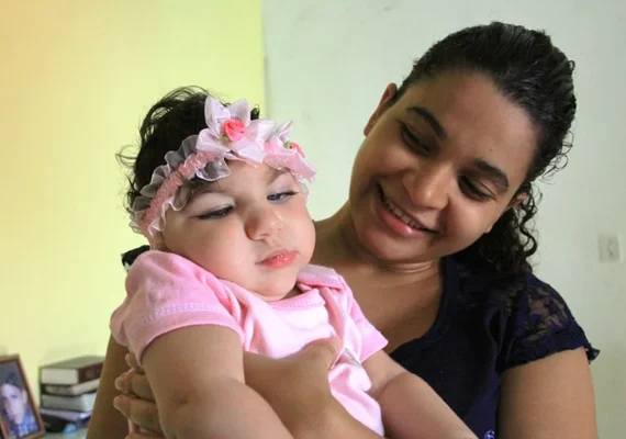 Crianças com microcefalia em Alagoas terão atendimentos médicos garantidos