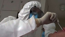 Laboratórios alertam para risco de desabastecimento de testes para covid-19