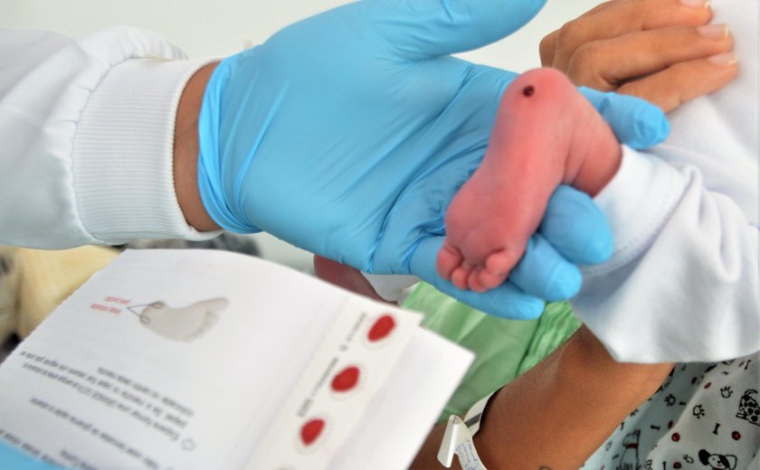 Pediatra da Sesau ressalta importância do Teste do Pezinho para diagnosticar sete doenças
