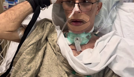 Ex-comandante da Segurança Pública de Alagoas apresenta avanços em recuperação após ser baleado em operação no Rio