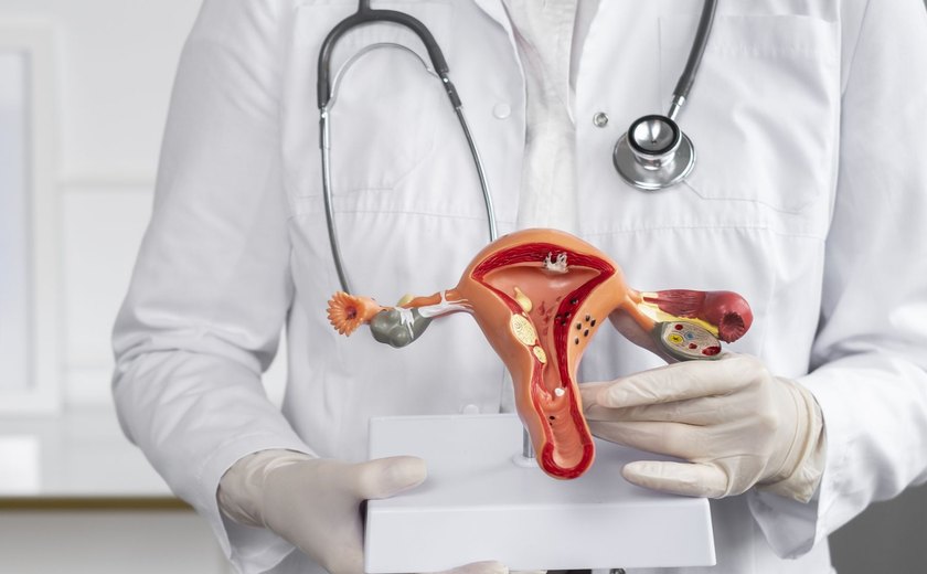 Alagoas tem o terceiro maior aumento de internações por endometriose no Brasil
