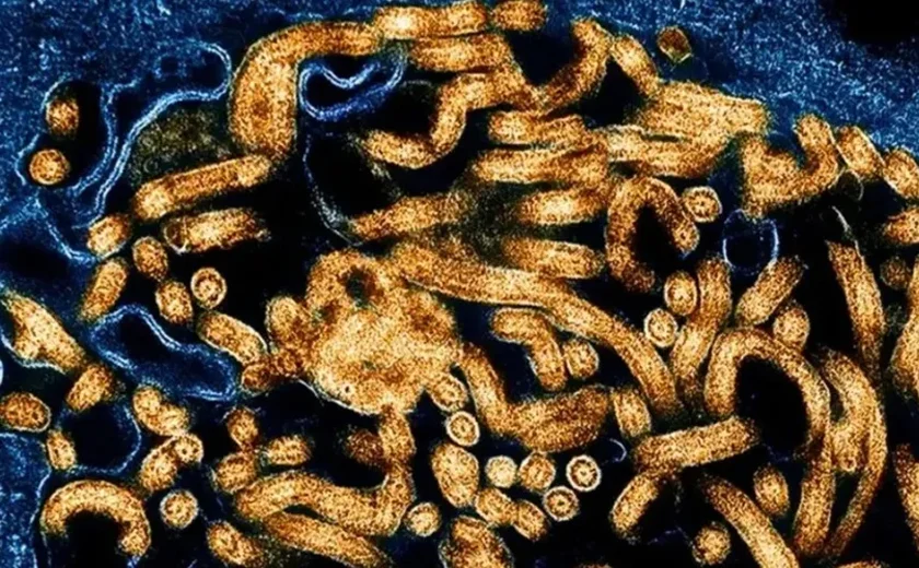 Organização Mundial da Saúde declara surto de ebola na África: “Emergência global”