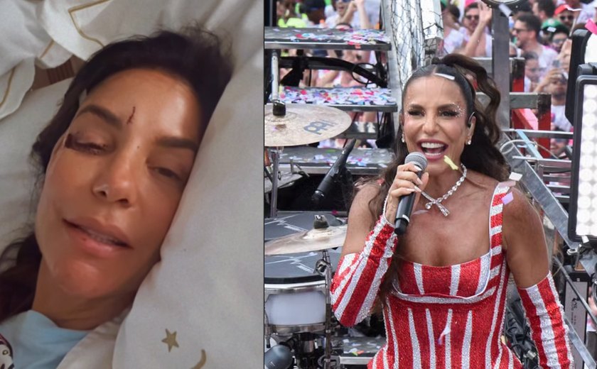 O que houve com Ivete Sangalo? Cantora surge machucada e explica motivo; veja vídeo