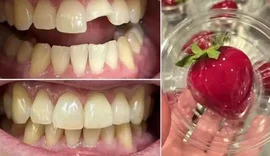 ‘Morango do Amor’ causa fraturas dentárias e dentistas alertam: ‘Bomba de açúcar’