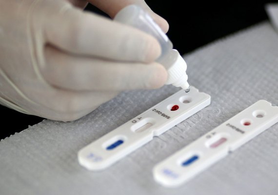 Alagoas confirma nesta segunda-feira 149 novos casos de Covid-19 e mais 24 mortes