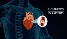 Droga que inativa micróbios no intestino pode prevenir doença cardiovascular