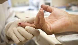 Remédio que previne contaminação pelo vírus HIV será oferecido pelo SUS