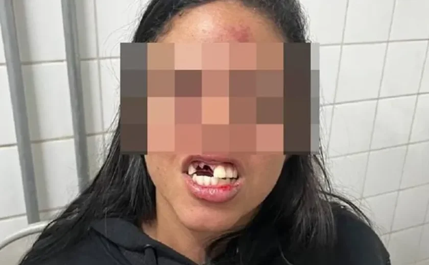 Homem agride três mulheres dentro de um bar e deixa uma com dentes quebrados