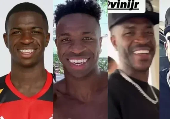 Antes e depois do craque Vini Jr: suposta harmonização, barba, novo sorriso e mais