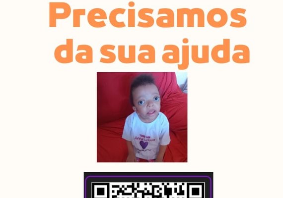 Família luta para arrecadar fundos para cirurgia de criança com craniossinostose