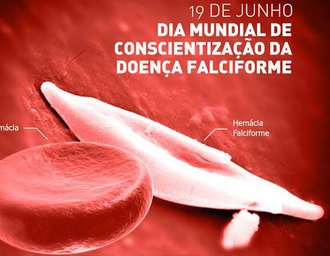 Doença falciforme soma 800 casos em Alagoas e reforça alerta por assistência adequada