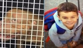 Criança de 5 anos morre após ataque de pitbull no Rio de Janeiro