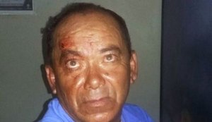 Idoso de 71 anos denuncia o filho após ser espancado a golpes de pau