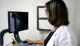 Alagoas realizou mais de 24 mil mamografias de janeiro a abril de 2022