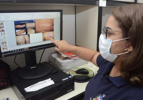 Sesau inscreve agentes comunitários de saúde para capacitação sobre hanseníase