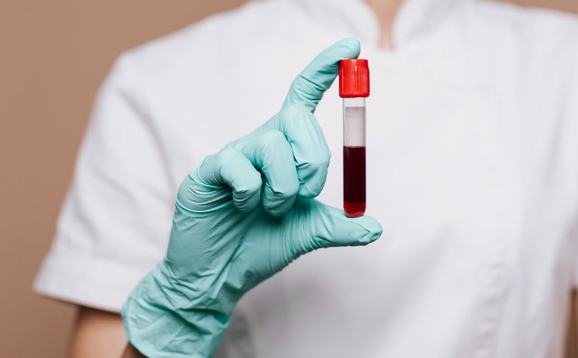 Exames de sangue ajudam a identificar riscos cardiovasculares antes dos sintomas