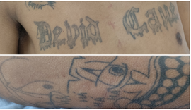 Hospital de Emergência do Agreste procura familiares de paciente identificado apenas como Rafael