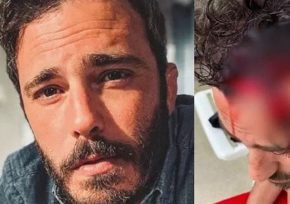 Thiago Rodrigues é espancado por bandidos no Rio de Janeiro e encontrado desacordado na rua