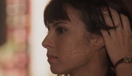 “Tempo de Amar”: Tragédia no passado deixou cicatriz no rosto de Lucinda