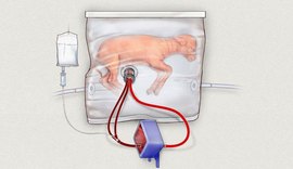 Cientistas desenvolvem útero artificial para ajudar bebês prematuros