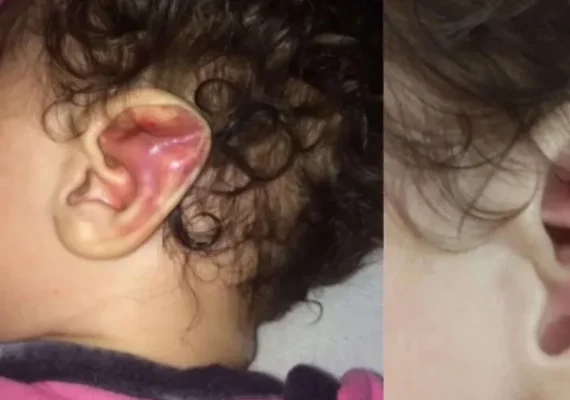 Mãe é presa após  torturar e fraturar costelas de filha de seis meses em 2021