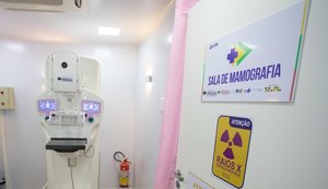 Ministério da Saúde leva carreta de saúde da mulher a União dos Palmares