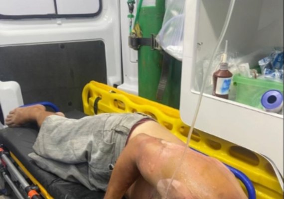 Homem de 43 anos tem 40% do corpo queimado pela própria esposa durante discussão