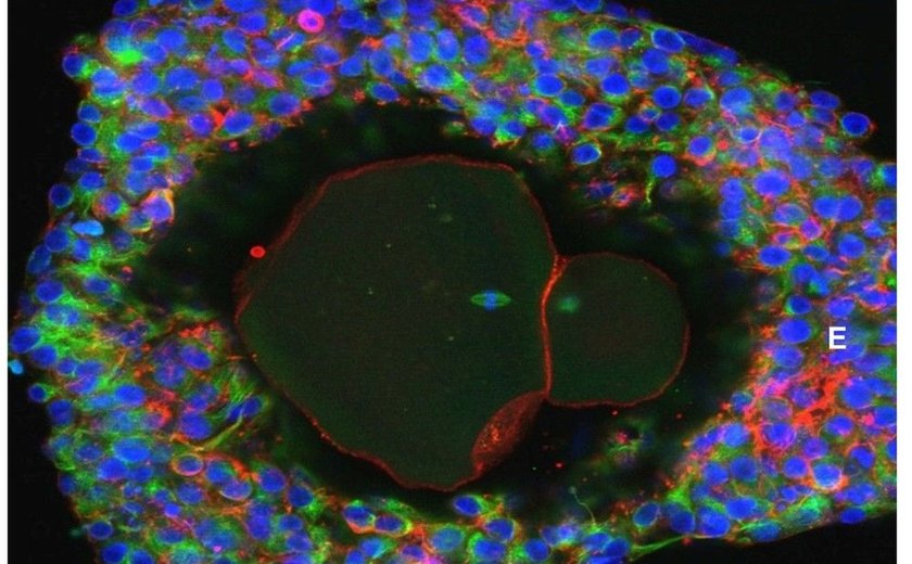 Cientistas desenvolvem óvulos humanos em laboratório até a maturidade