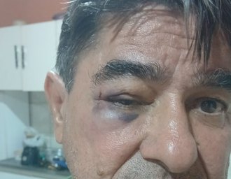 Ex-prefeito de Olivença é agredido em confusão no Centro da cidade