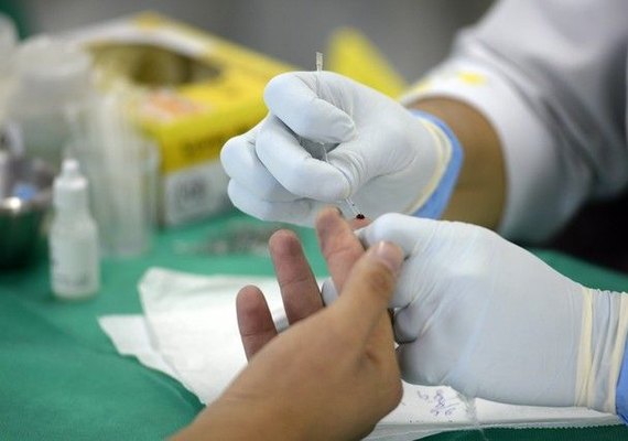Brasil tem 12,6 casos de hepatite C a cada 100 mil habitantes
