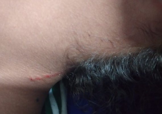 Adolescente de 14 anos é agredida dentro de escola municipal e é levada para o HGE