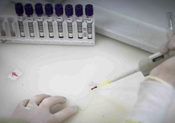 Paciente em SP com suspeita de ebola testa positivo para meningite