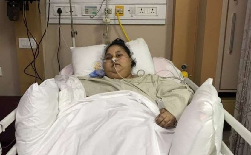 'Mulher mais pesada do mundo' perde 100 kg após cirurgia