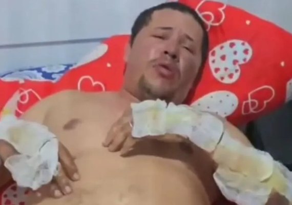 Motorista por aplicativo queimado vivo pede ajuda