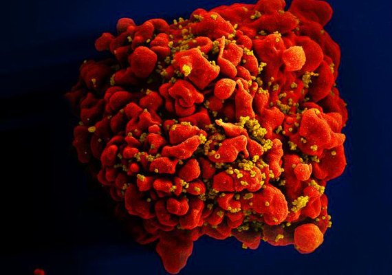 Vacina contra HIV é testada em cinco países e protege mais de 67% dos macacos