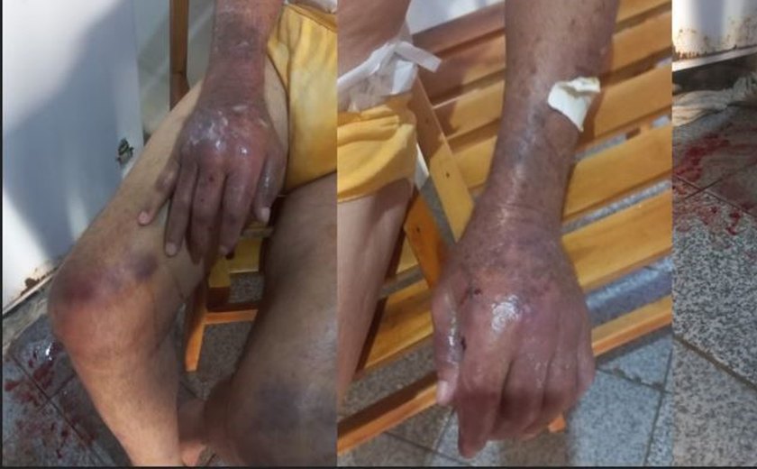 Filha é presa por maus-tratos e omissão de socorro contra idoso em Belo Monte