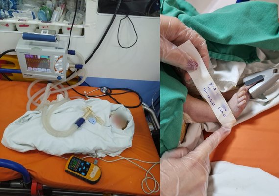 Samu atua em parto pélvico no Benedito Bentes, mas bebê é internado em estado grave