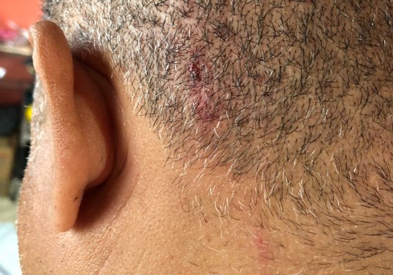 Moradores dos Flexais, em Bebedouro, denunciam onda de assaltos na região