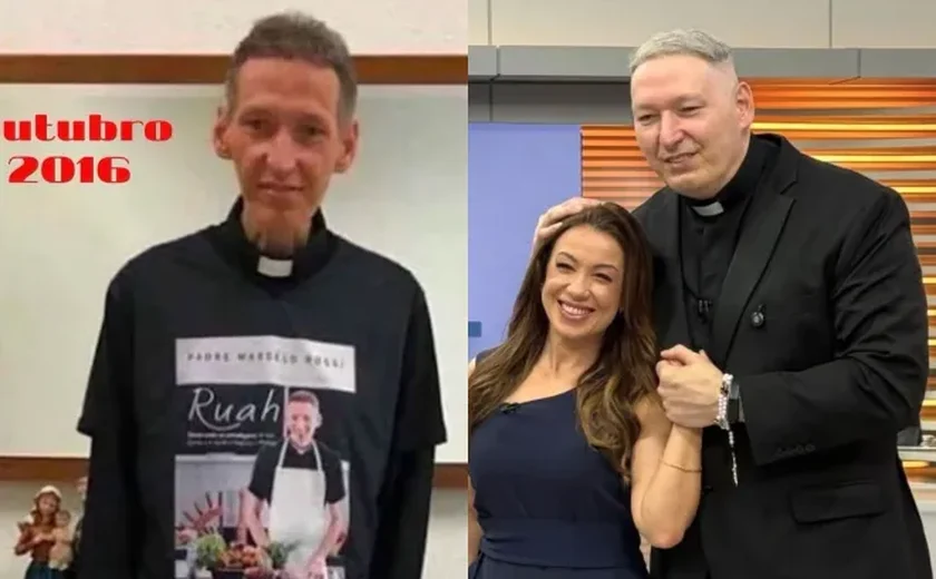 Padre Marcelo Rossi celebra vitória contra a depressão e mostra antes e depois
