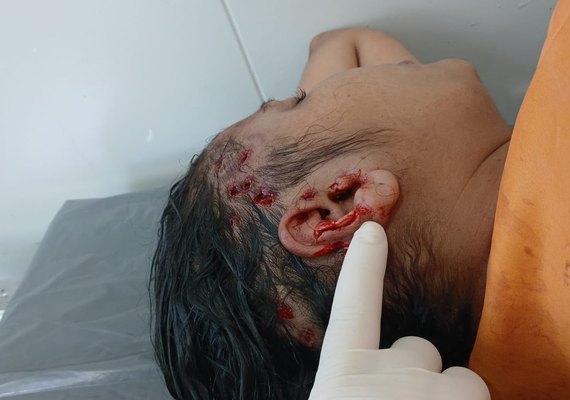 Mulher é agredida por quatro pessoas durante bebedeira em Paulo Jacinto