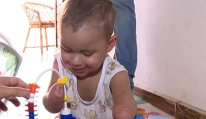 Milagre e superação: a luta do pequeno Noah após amputações