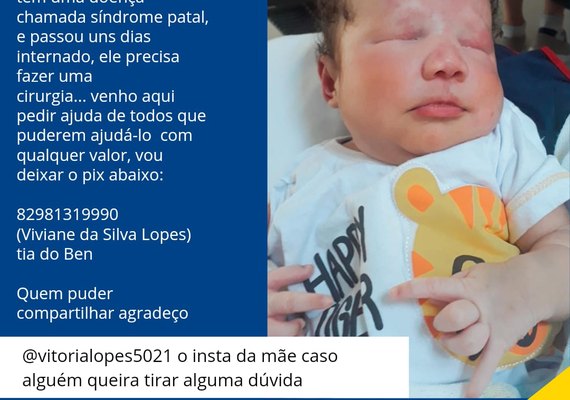 Família pede ajuda para bebê que necessita de cirurgia
