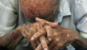 Jovem invade casa e agride idoso de 76 anos para roubar passarinho
