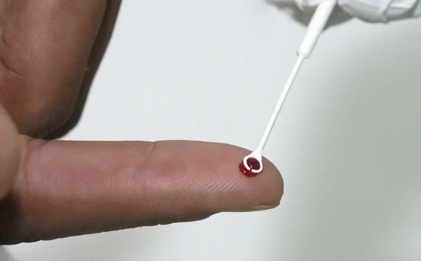 Fiji declara emergência nacional por HIV com 1 caso a cada 60 pessoas