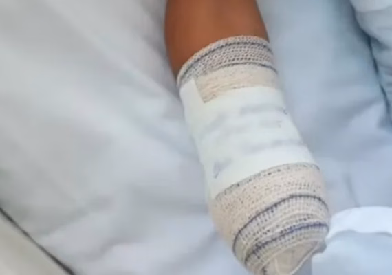 Criança perde a mão após confundir bomba com peça de bicicleta no Rio