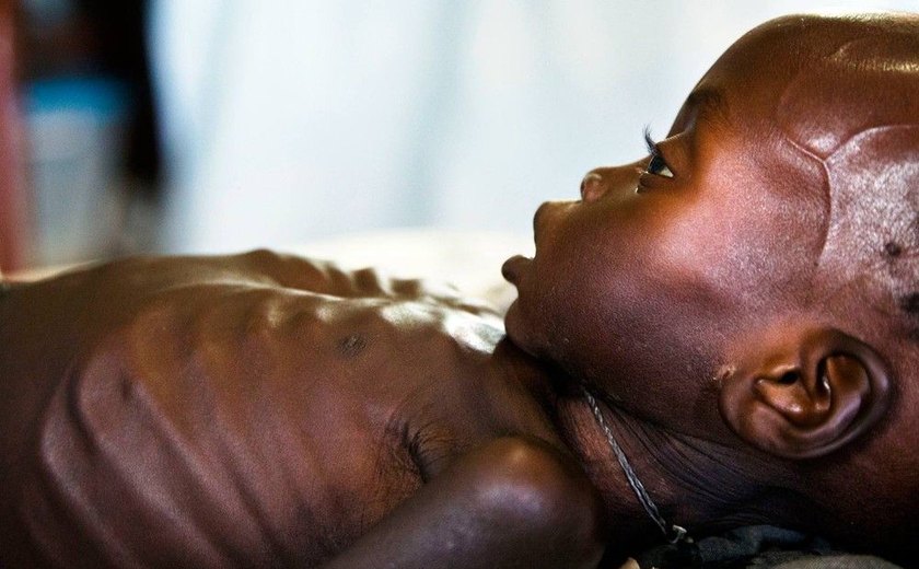 Segundo a ONU, 1,4 milhão de crianças correm risco iminente de morrer de fome